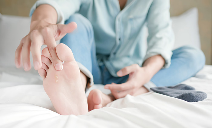 Types-of-foot-fungus-Applying-cream-athletes-foot