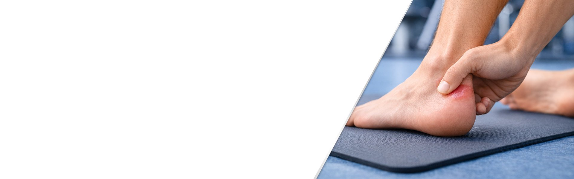 background-blisters-on-feet