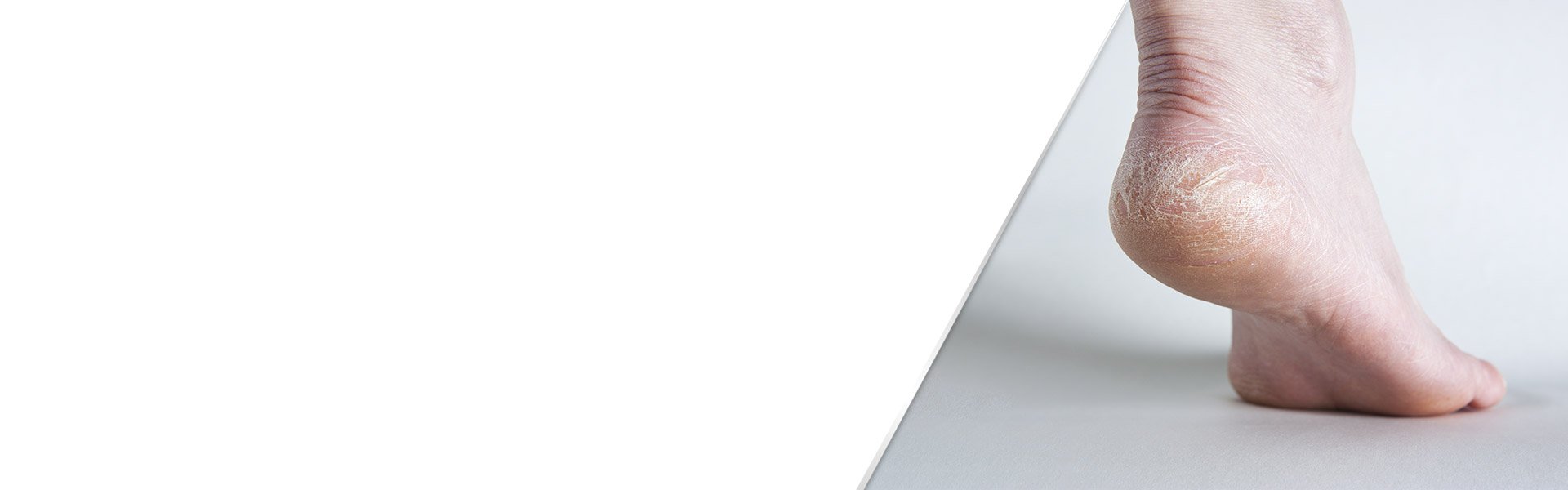 background-dry-cracked-feet