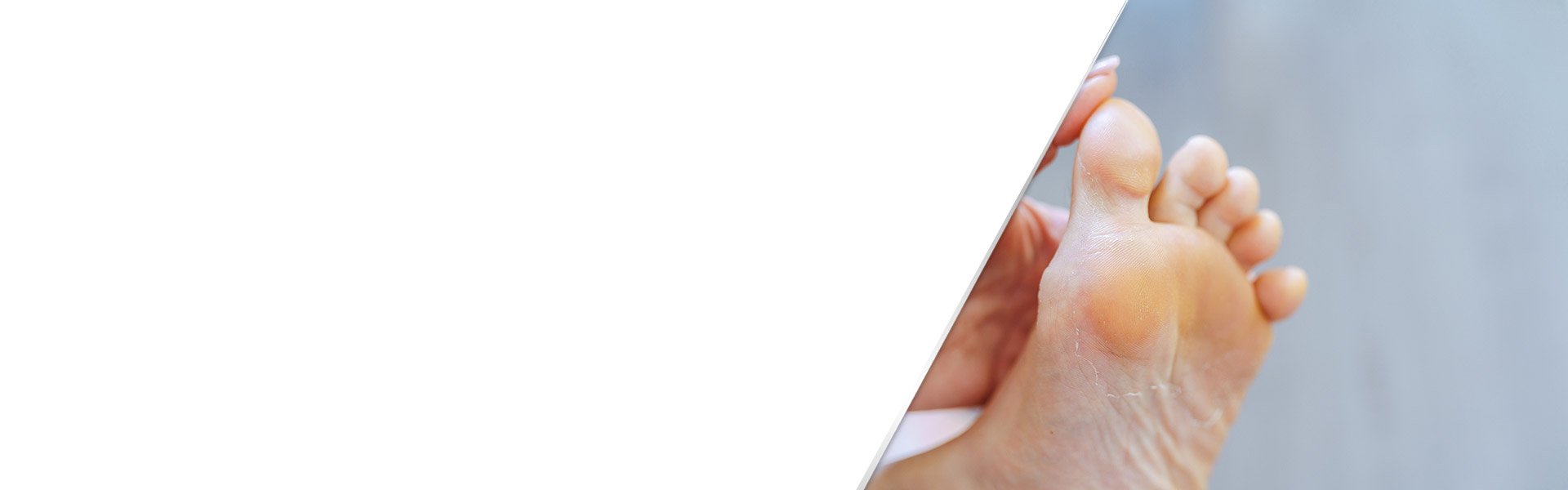 background-peeling-skin-on-the-feet