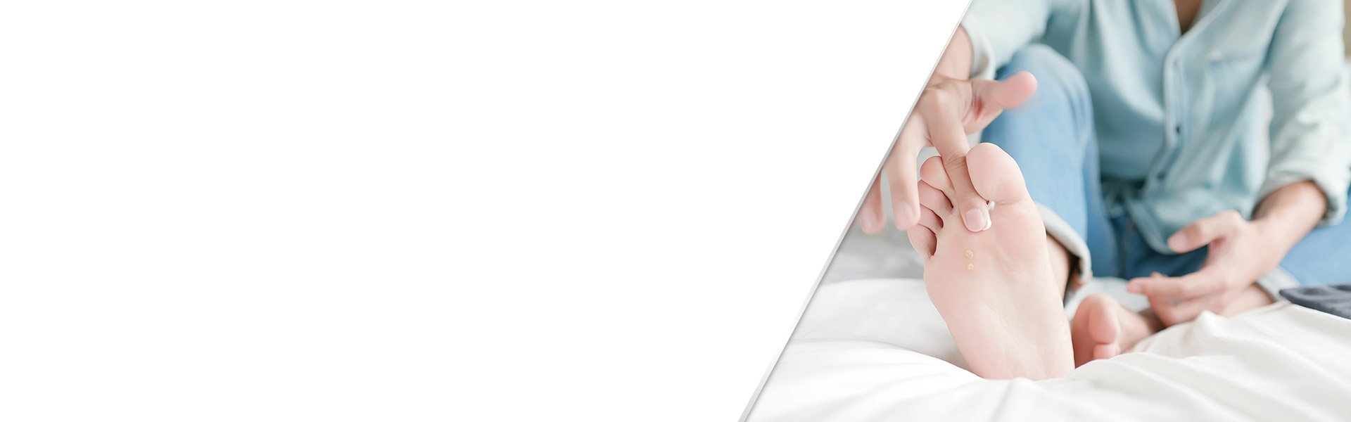 background-types-of-foot-fungus